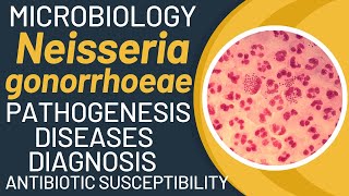 Neisseria gonorrhoeae pathogenesis  Gonorrhoea pathogenesis and microbiology [upl. by Sparky479]