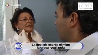 Lipólisis exprés Eliminación de la grasa localizada con Aqualyx cirugiaplastica [upl. by Romine]