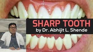 Sharp Tooth [upl. by Lezah]