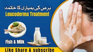 Leucoderma Treatment  برص کی بمیاری کا خاتما  Salty Milk  Milk And Fish  رایتہ [upl. by Mcgrath]