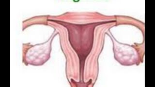 Causes of Vaginitis  USMLE high yield Step 2 CK [upl. by Pollie814]