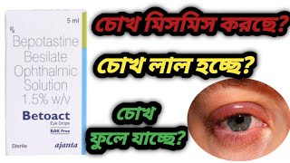 Betoact eye drops benefits use in bengali review চোখ লাল হওয়া সমস্যা সমাধান করে। [upl. by Gensler360]