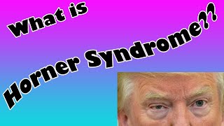 Horners Syndrome Explained [upl. by Idnyl775]