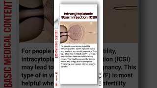 Intracytoplasmic Sperm Injection ICSI icsi ivf pregnancy sperm [upl. by Euqnimod]