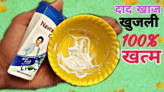 दाद खाज खुजली कितना भी पुराना हो यह लगा लो एक दिन में छुट्टी कर देगा Fast fungal ringworm treatment [upl. by Ellemac]