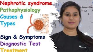 Nephrotic Syndrome  Types  Pathophysiology  Symptoms  Causes  Diagnose  Treatment [upl. by Ansley413]