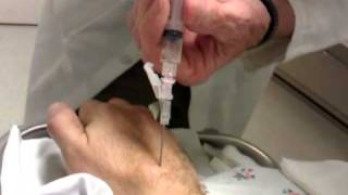 Ganglion Cyst aspiration  removal D [upl. by Luigino441]