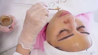 Experience flawless skin with Dermamelan at Lucia Clinic [upl. by Okiruy586]