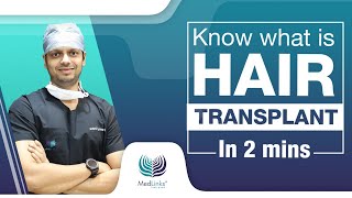 What is hair transplant in 2 MINS  by Dr Gaurang krishna MedLinks Hair Transplant in Delhi [upl. by Uon]