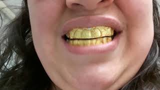 How to get Gold foil Grillz  with this [upl. by Aihseym]