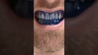 How to use disclosing tablets shorts teeth [upl. by Trubow]