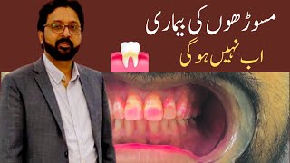 How to Use DENTAL PLAQUE Disclosing Tablets to Prevent Gum Disease [upl. by Camarata]