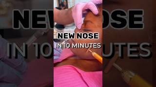 Refine your look with a perfect nose transformation aesthetics nose nosetransformation medspa [upl. by Bill798]