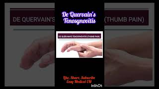 What is De Quervains TenosynovitisPhysiotherapy for Thumb Pain thumbpainshortvideo shortfeed [upl. by Phares818]