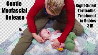 31R Gentle Myofascial Release RightSided Torticollis Treatment in Babies [upl. by Norean]