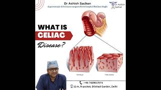 Symptoms of Celiac disease DrAshishSachan [upl. by Tnahsin]