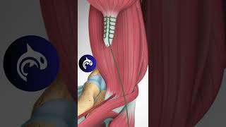 See how a Distal Biceps Tendon Rupture is repaired  3D Animation biceps triceps workout [upl. by Phenica875]