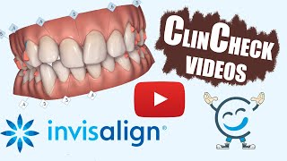 Invisalign ClinCheck Videos For Various Teeth Conditions [upl. by Ayekim]