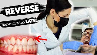 How To Treat Gum Disease [upl. by Watkins]