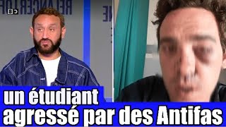 Un étudiant Agressé par des Antifas dans son université 😡 le Tshirt anti J  UIF 🤦‍ TPMP réaction [upl. by Aivataj]