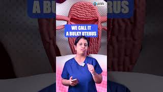 What You Need To Know About Adenomyosis  Dr Deepthi Jammi [upl. by Elena820]