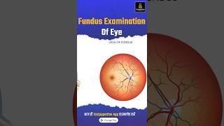 Funds Examination of eye explained simply in less than 60seconds funds examination ophthalmology [upl. by Jenkel]