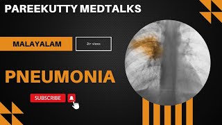 PNEUMONIA  MALAYALAM DESCRIPTION  CAUSES  PATHOLOGY  SYMPTOMS  DIAGNOSIS  TREATMENT [upl. by Silyhp]