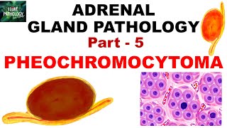 Adrenal Gland Pathology Part 5 PHEOCHROMOCYTOMA  Genetics  clinical features  Pathology [upl. by Nanji]