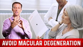 How to Prevent Macular Degeneration – Dr Berg [upl. by Ettolrahs]