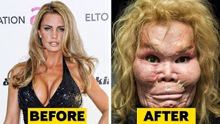 20 Celebrity Plastic Surgery Disasters [upl. by Hadley922]