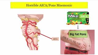 12DaysinMarch Stroke Localization Brainstem Part 3 of 3 for the USMLE Step One Exam [upl. by Arrej]