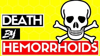 Can You Die From A Hemorrhoid Do Piles Cause Death  Best Hemorrhoids amp Piles Answers [upl. by Atig]