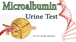 Microalbumin MA Urine Albumin Albumin to Creatinine Ratio [upl. by Greenburg]