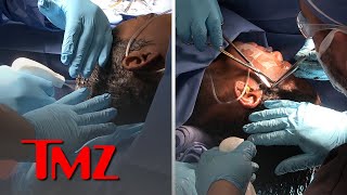 Tessica Brown Gets Gorilla Glue Out of Hair Video of Surgery  TMZ [upl. by Atiniuq]