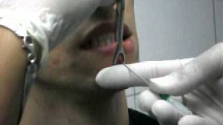 Aplicação de Piercing no Lábio  Diogo [upl. by Aver399]