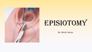 OampG Episiotomy  for medical students [upl. by Messere]