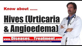 Hives Urticaria amp Angioedema  Causes Diagnosis Symptoms Treatment [upl. by Adikram]