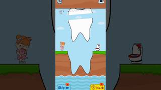 Slice this teeth🦷 to save trending viralvideo funny shorts [upl. by Ys36]