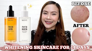 14 Days Challenge  NACIFIC Phyto Niacin Whitening Essence amp Fresh Herb Origin Serum Glass Skin [upl. by Garland]