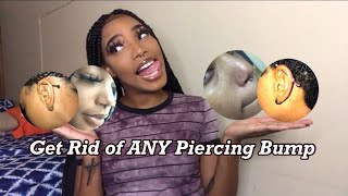 How to Get Rid of ANY KeloidPiercing bump FAST no tea tree oil JUSTTRISH [upl. by Adnik]