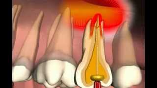 Paranasal Sinuses [upl. by Aras]