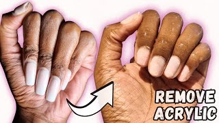 How to REMOVE ACRYLIC NAILS AT HOME  TAKE OFF ACRYLIC NAILS with ACETONE [upl. by Duester]