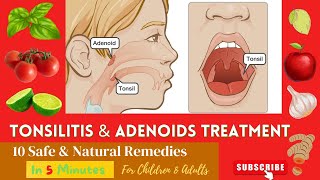 10 Best Effective Proven Home Remedies For Enlarge  Swelling ADENOIDS and TONSILS In Children [upl. by Sihonn237]