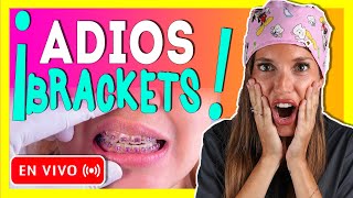 🎥𝐑𝐄𝐓𝐈𝐑𝐎 𝐝𝐞 𝐎𝐑𝐓𝐎𝐃𝐎𝐍𝐂𝐈𝐀 en 𝒗𝒊𝒗𝒐 Como se 𝗤𝗨𝗜𝗧𝗔𝗡 los BRACKETS y se ponen los RETENEDORES ORTODONCIA🔥 [upl. by Haeel]