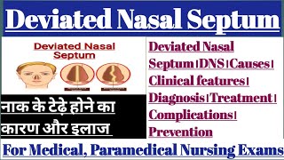 Deviated Nasal Septum।DNS।deviated septum surgery।septoplasty।nose injury।deviated septum treatment [upl. by Sublett]