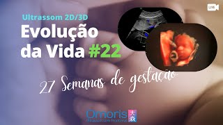 Gravidez 27 semanas  Quais as causas das dores pélvicas Baixo Ventre  Evolução da Vida 22 [upl. by Tanner]