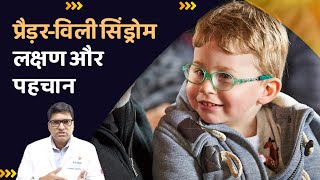 What is Prader Willi Syndrome प्रेडरविली सिंड्रोम से बच्चों में आती हैं ये स्वास्थ्य समस्याएं [upl. by Kcirded750]