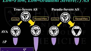 Emory Cardiology Grand Rounds 11032014 [upl. by Navillus]