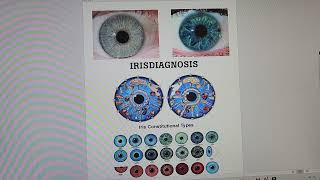 What is Iridology [upl. by Rebekkah]