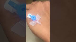 IV cannula insertiondocternursingtrendingforyouyoutubelovepopularviralvideoshortvideo [upl. by Sirama]